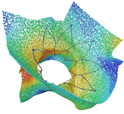 tricuspid stent valve deployment expansion